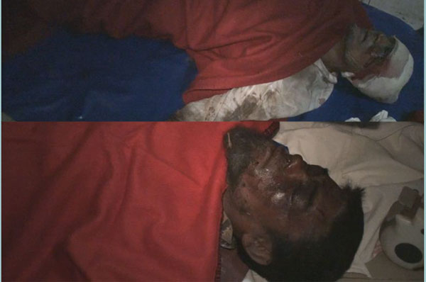 সাতক্ষীরায় বোমা বানাতে গিয়ে দুই 'ডাকাত' দগ্ধ