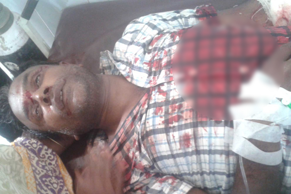 শ্রীপুরে প্রকাশ্যে কুপিয়ে বিএনপি নেতার হাতের কব্জি বিচ্ছিন্ন