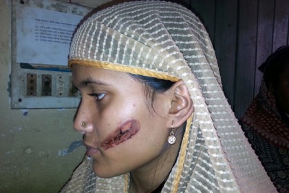 যৌতুক না পেয়ে গৃহবধূর ওপর বর্বর নির্যাতন   