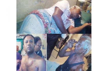 বেগমগঞ্জে বাড়িতে ঢুকে হামলা, আহত ১০