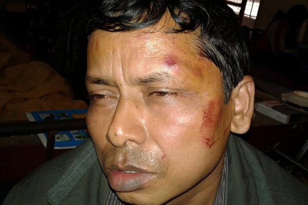 ঠাকুরগাঁওয়ে প্রধান শিক্ষকের বিরুদ্ধে সহকর্মীকে পেটানোর অভিযোগ