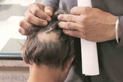 দ্বিতীয় শ্রেণির ছাত্রীর মাথার চুল ছিঁড়ে নিলেন শিক্ষিকা!

