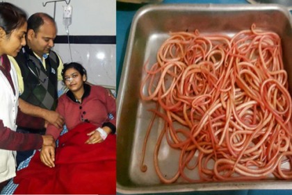 তরুণীর পেট থেকে দেড়শ' কৃমি উদ্ধার