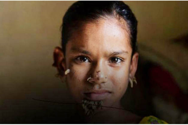 বার্ণ ইউনিটে ভর্তি শাহানা কি বৃক্ষ মানবী!