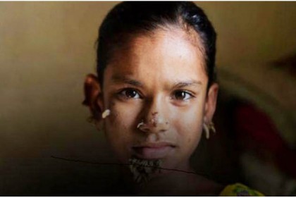 বার্ণ ইউনিটে ভর্তি শাহানা কি বৃক্ষ মানবী!