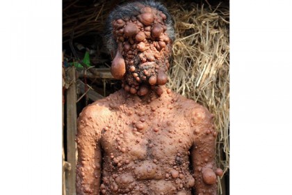 স্বাভাবিক জীবনে ফিরতে চান শাহাদত