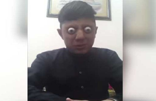 এই ভিডিওটি দুর্বলচিত্তদের জন্য নয়!