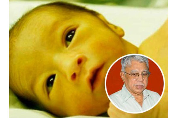 সদ্যোজাতদের জন্ডিস প্রতিরোধের উপায় আবিষ্কার  

