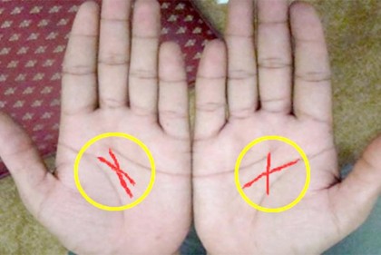 হাতের ‘এক্স’ চিহ্ন সৌভাগ্যের ইঙ্গিত দেয়