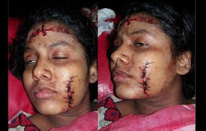 প্রেমে রাজি না হওয়ায় মাদ্রাসা ছাত্রীকে কোপাল শিবির ক্যাডার