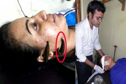 তরুণীর শরীরের দূষিত রক্ত শুষে নিচ্ছে জোঁক!