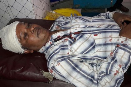দিনাজপুরে সড়ক দুর্ঘটনায় কালের কণ্ঠের সাংবাদিক আহত