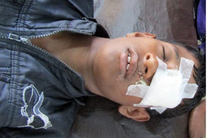 মোরেলগঞ্জে মাদক ব্যবসায়ীদের হামলায় আহত ৩