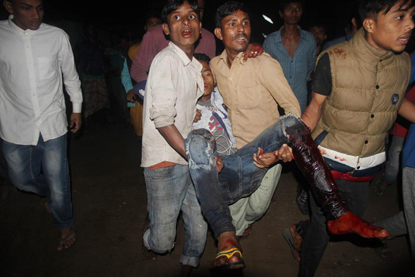 বোমা হামলায় আহত ২৬ জন ওসমানীতে চিকিৎসাধীন