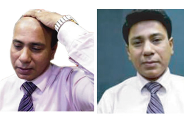 দেশের বাইরেও সেবা দিচ্ছে 'হেয়ার লাইফ ইন্টারন্যাশনাল'