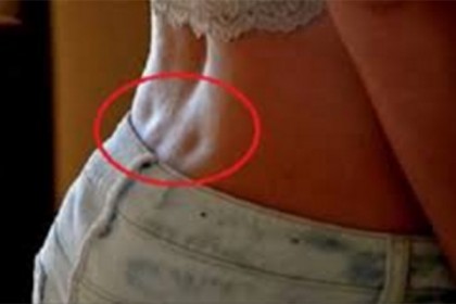 আপনার পেছনেও কি রয়েছে 'ভেনাস হোল'?