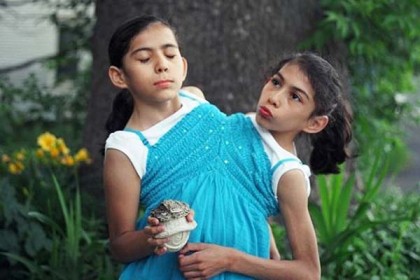দুই বোন এক দেহে ১৬ বছর ধরে!