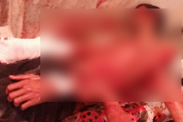 পটুয়াখালীতে ৪ জনকে কুপিয়ে জখম