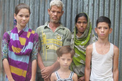 পরিবারে ৫ সদস্যের ৪ জনই প্রতিবন্ধী 