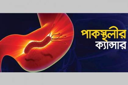 পাকস্থলীতে ক্যান্সার প্রতিরোধ করবেন যেভাবে