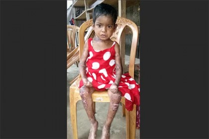 ধুঁকে ধুঁকে শেষ হচ্ছে অজ্ঞাত রোগে আক্রান্ত শিশু মাহমুদা
