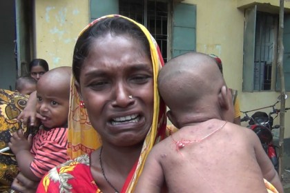 পঞ্চগড়ে স্কেবিস রোগের প্রাদুর্ভাব, পাওয়া যাচ্ছে না প্রতিষেধক 