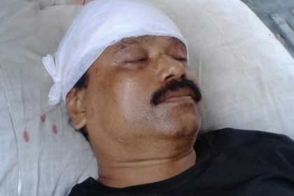 পিরোজপুরে কলেজ শিক্ষককে কুপিয়ে জখম
