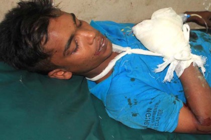 কুড়িয়ে পাওয়া ককটেল বিস্ফোরণে কিশোর আহত