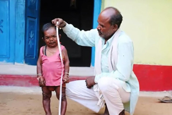 দেখতে 'শিশু' বয়সে বৃদ্ধ