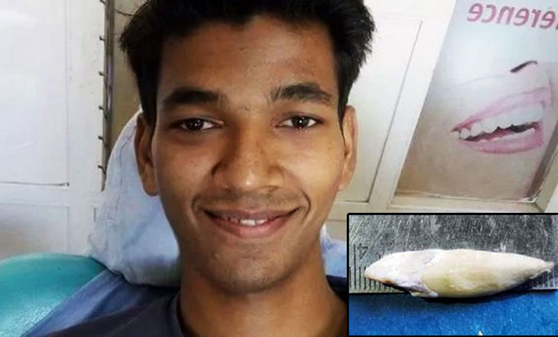 লম্বা দাঁতের রেকর্ডে গিনেস বুকে নাম লেখালেন এই যুবক