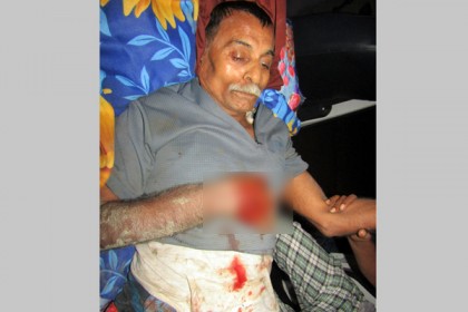 মুক্তিযোদ্ধাকে পিটিয়ে হাত-পা ভাঙলেন আওয়ামী লীগ নেতা