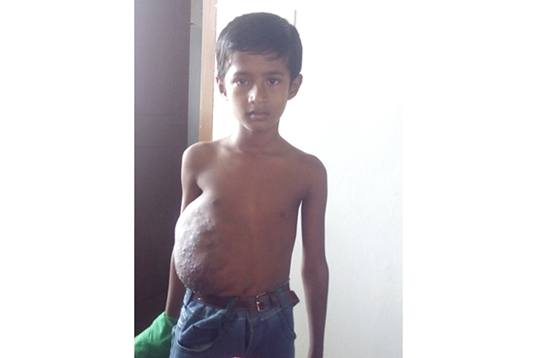 টাকার অভাবে চিকিৎসা পাচ্ছেনা শিশু নাফিজ