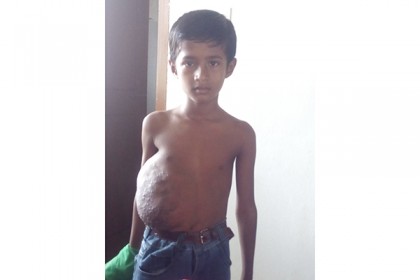 টাকার অভাবে চিকিৎসা পাচ্ছেনা শিশু নাফিজ