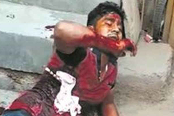 পানি না দিয়ে রক্তাক্ত যুবকের ভিডিও করায় ব্যস্ত সবাই!