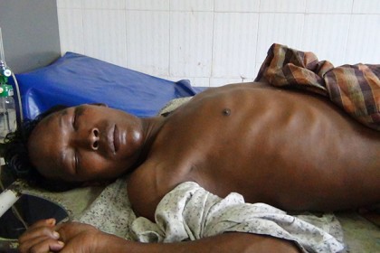 পঞ্চগড়ে সাইকেল চোরের লিঙ্গ কর্তন!