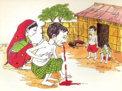 দেশে প্রতি লাখে ২২৫ জন যক্ষা রোগে আক্রান্ত