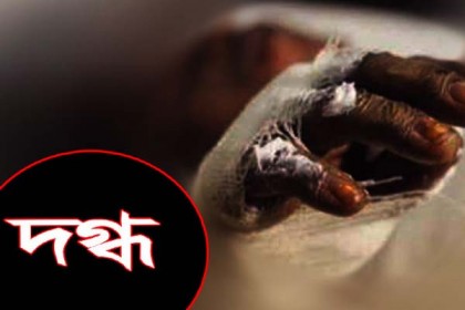 রাজধানীতে গ্যাস পাইপ লিকেজ, অগ্নিকাণ্ডে দগ্ধ ৩