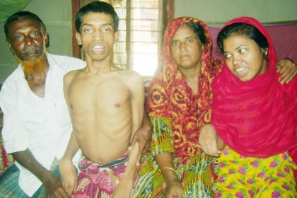 নওগাঁয় প্রতিবন্ধী দুই সন্তানকে নিয়ে বিপাকে পরিবার