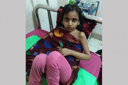 মুক্তামণির অপারেশন চলছে, হাতে লাগানো হচ্ছে চামড়া 