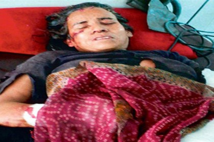 ‌চিতাবাঘের সঙ্গে খালি হাতেই লড়াই দুই নারীর, অতঃপর...!