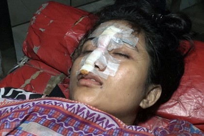 বরিশালে বখাটের ছুরিকাঘাতে কলেজছাত্রী রক্তাক্ত
