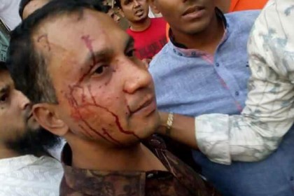 হামলায় আক্রান্তরা সবাই সাংবাদিক