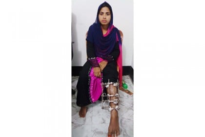 ৩ বছরেও সুস্থ হয়নি বিলকিস, বিত্তবানদের সহযোগিতা চায় পরিবার