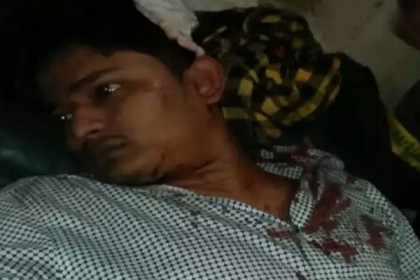 রায়পুরে ব্যাংকের এজেন্টকে কুপিয়ে জখম