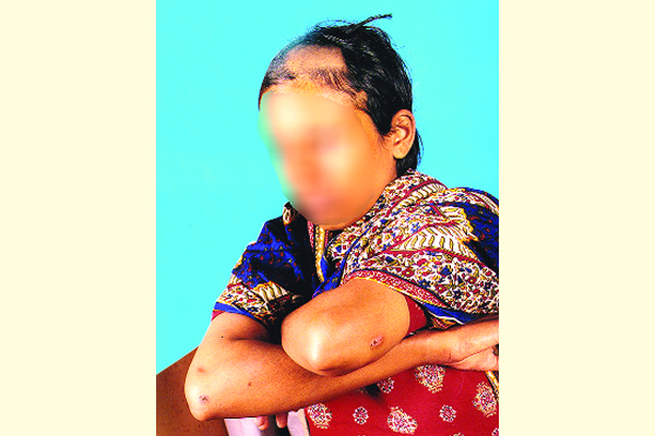 গৃহবধূর চুল-ভ্রু কেটে দেওয়ার ঘটনায় শ্বশুর গ্রেফতার