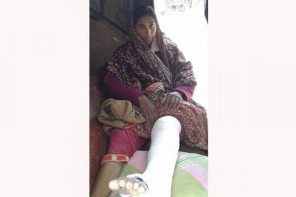 নাটোরে যৌতুকের টাকা না পেয়ে স্ত্রীর পা ভেঙে দিল স্বামী 

