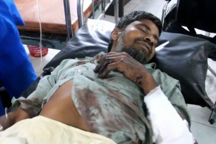 স্থলমাইন বিস্ফোরণে উড়ে গেল আওয়ামী লীগ নেতার দুই পা
