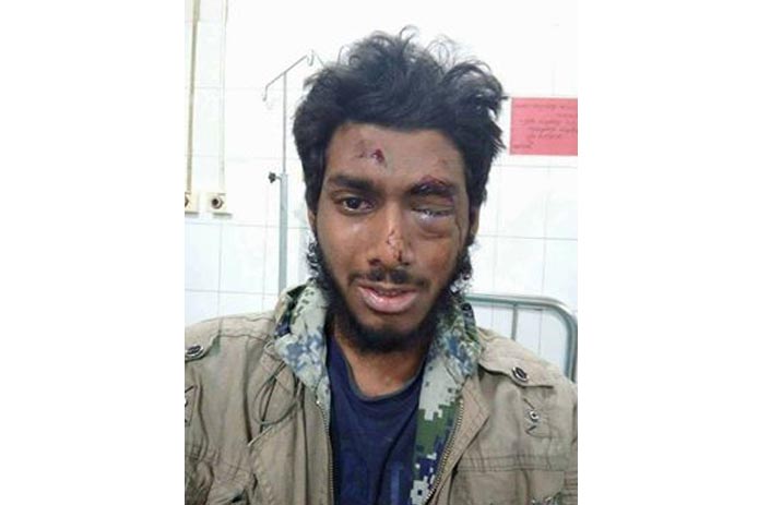 ছাত্রলীগের পিটুনিতে চোখ হারাতে বসেছে ঢাবি ছাত্র