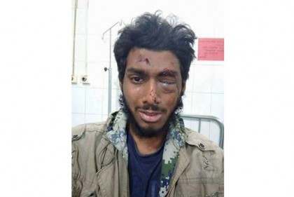 ছাত্রলীগের পিটুনিতে চোখ হারাতে বসেছে ঢাবি ছাত্র
