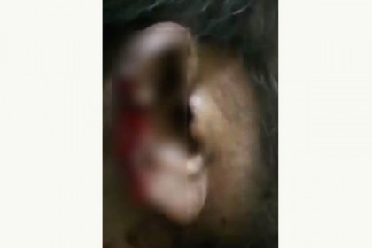 প্রতিবেশীর কান কামড়ে ছিঁড়ে নেওয়ার অভিযোগ, গ্রেফতার ২

